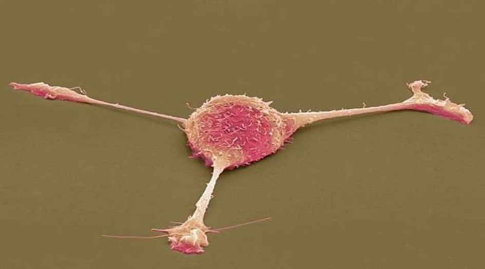 بشرى لمرضى السرطان... فيروس يقتل الخلايا السرطانية نهائيا