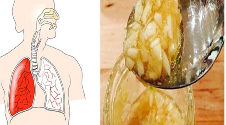 إذا أكلتم الثوم والعسل على الريق 7 أيام، هذا ما يحصل في جسمكم