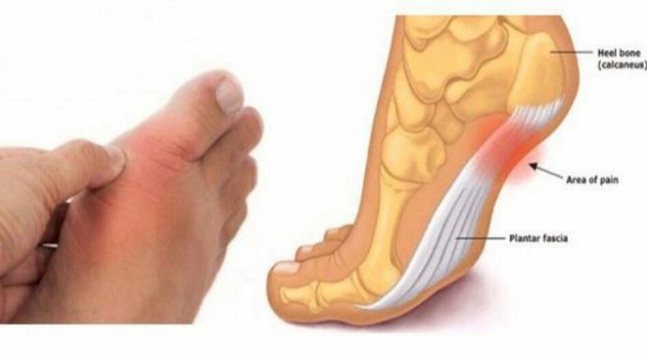11 عارضاً في قدميكم يخبركم عن أمراض والتهابات في جسمكم