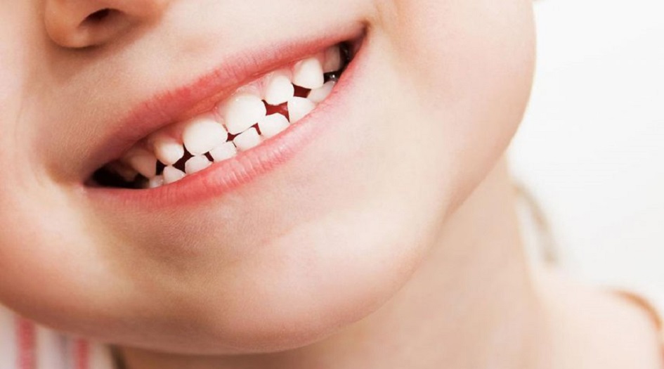 الأسنان اللبنية تنقذ حياة الاطفال عند الكبر وتعالج أمراض خطيرة