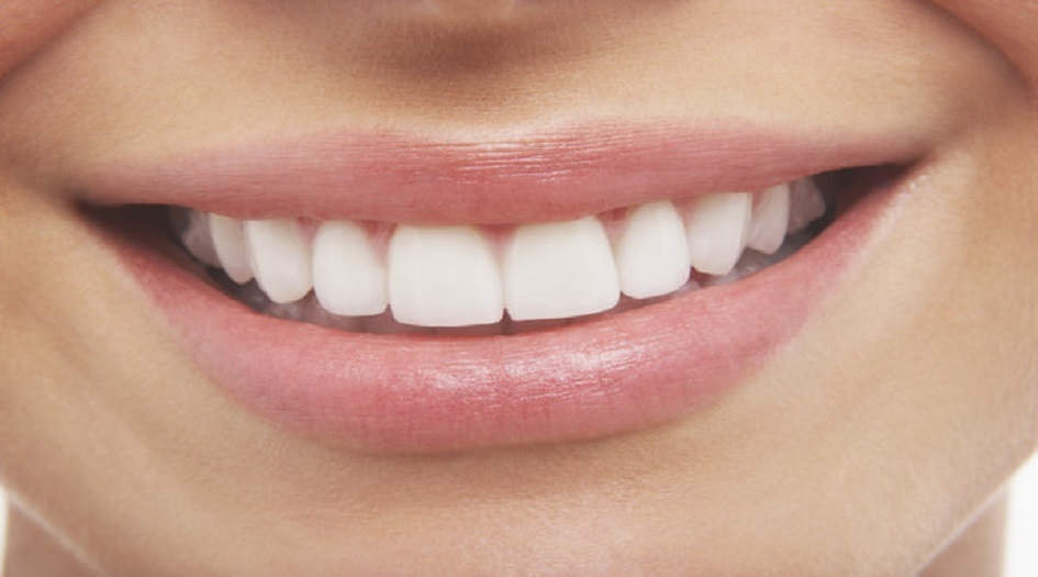 دراسة تكشف تأثير المبيضات على أنسجة الأسنان
