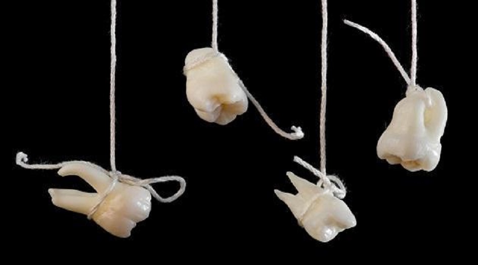 أخيراً اكتشفوا المعنى العلمي لحلم تساقط الأسنان… موت قريب؟