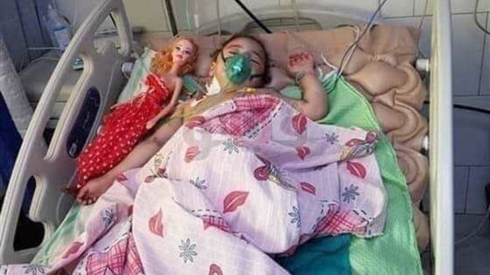 بالصور..وفاة طفلة تعرضت لتعذيب وحرق وبتر لساقها على يد جدتها
