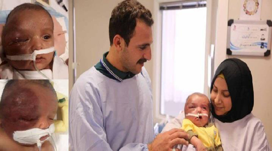 إنقاذ طفل عراقي مصاب بمتلازمة مميتة في المستشفى الرضوي