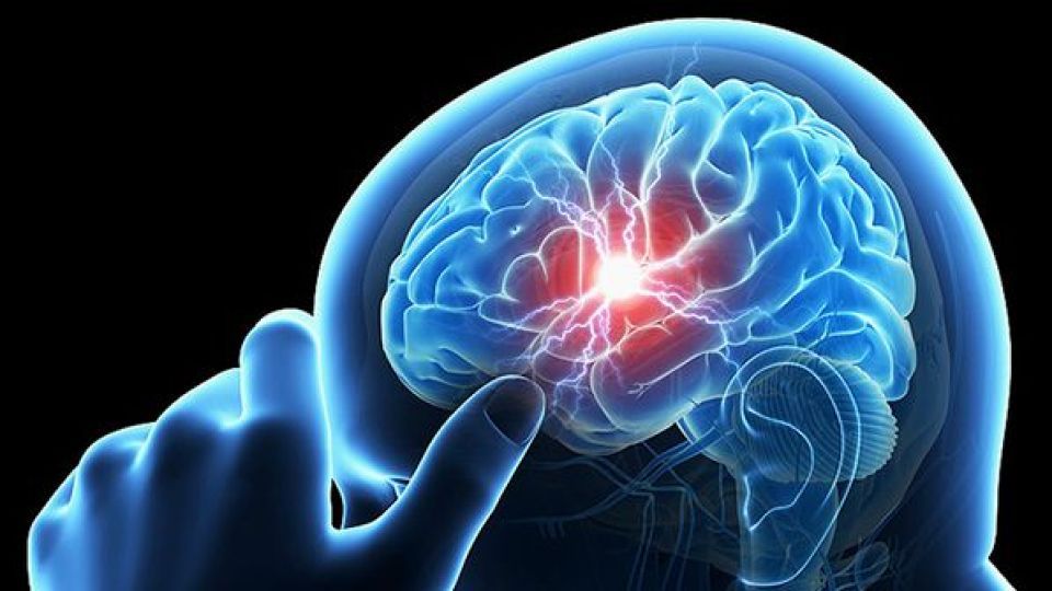 هوش مصنوعی خونریزی مغزی را تشخیص می‌دهد