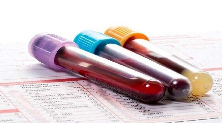 طريقة جديدة لتحليل الدم تكشف طول العمر