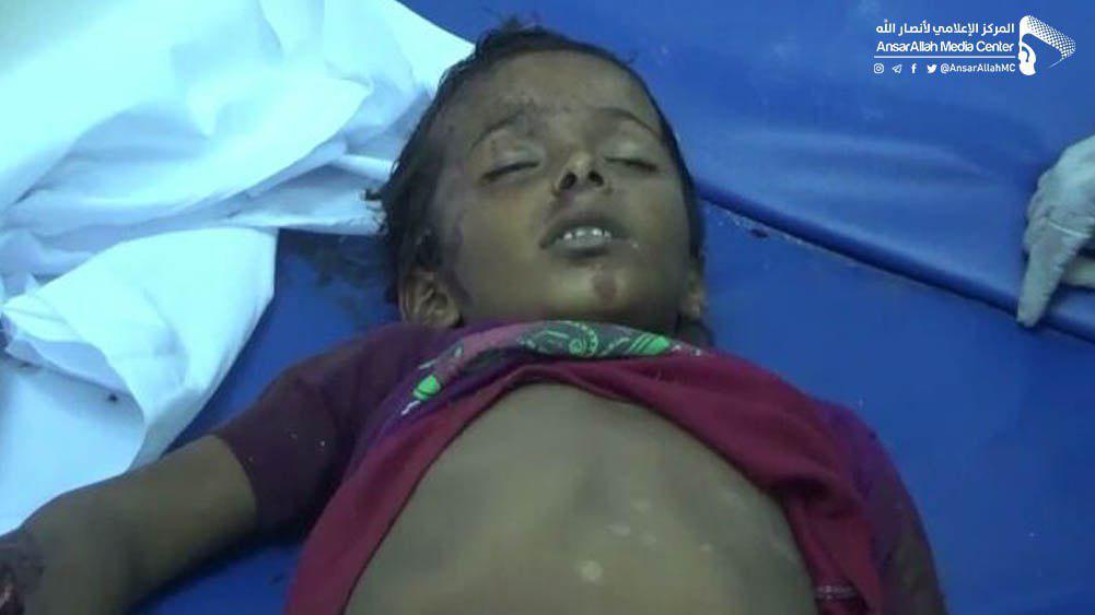 کشته شدن پنج کودک یمنی بر اثر انفجار بمب