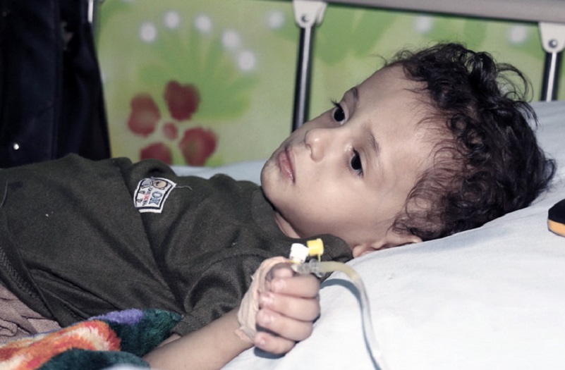 عشرات الوفيات من الأطفال اليمنيين المصابين بسرطان الدم نتيجة الحصار والعدوان