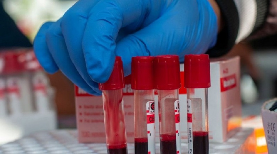 علماء يكتشفون.. دواء يكافح سرطان الدم 