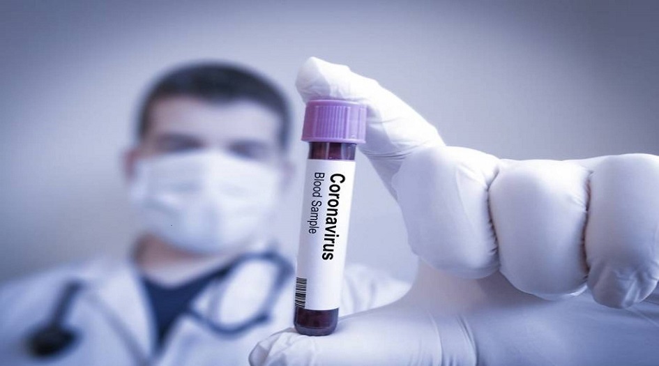 اثبت فعاليته.. إيطاليا تبدأ باستخدام علاج لفيروس كورونا