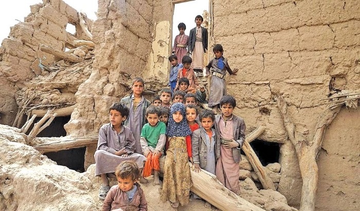 جنگ یمن، این کشور را از دو دهه توسعه محروم کرد