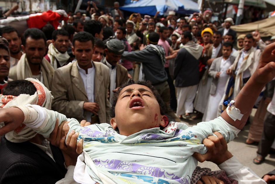 وزیر بهداشت یمن: سازمان ملل ۲ بار کودکان یمنی را کشت