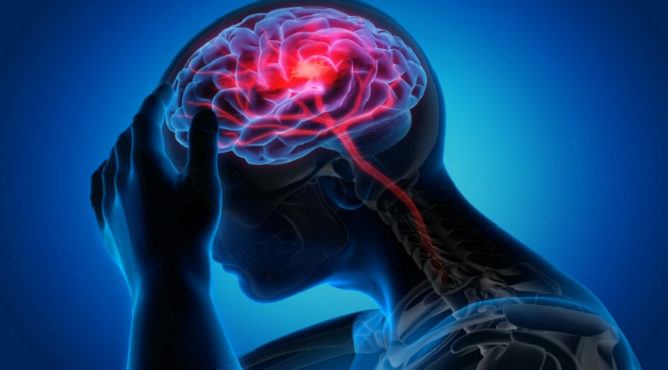 كيف يؤثر "كوفيد-19" على الدماغ!