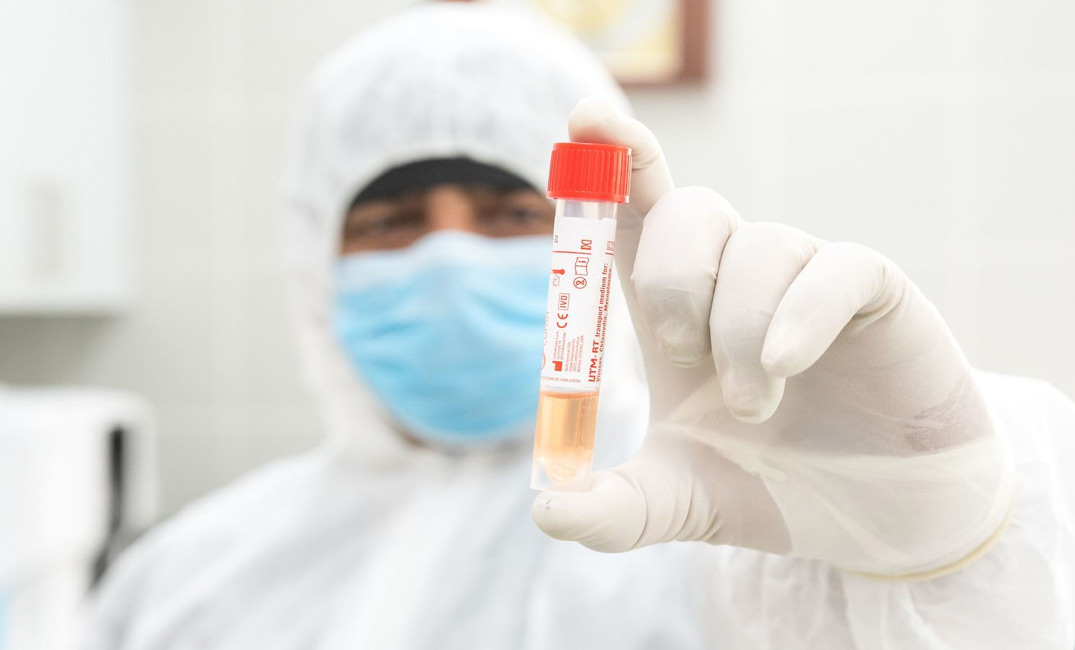 علماء الفيروسات يكشفون عن مستقبل اللقاح الروسي 