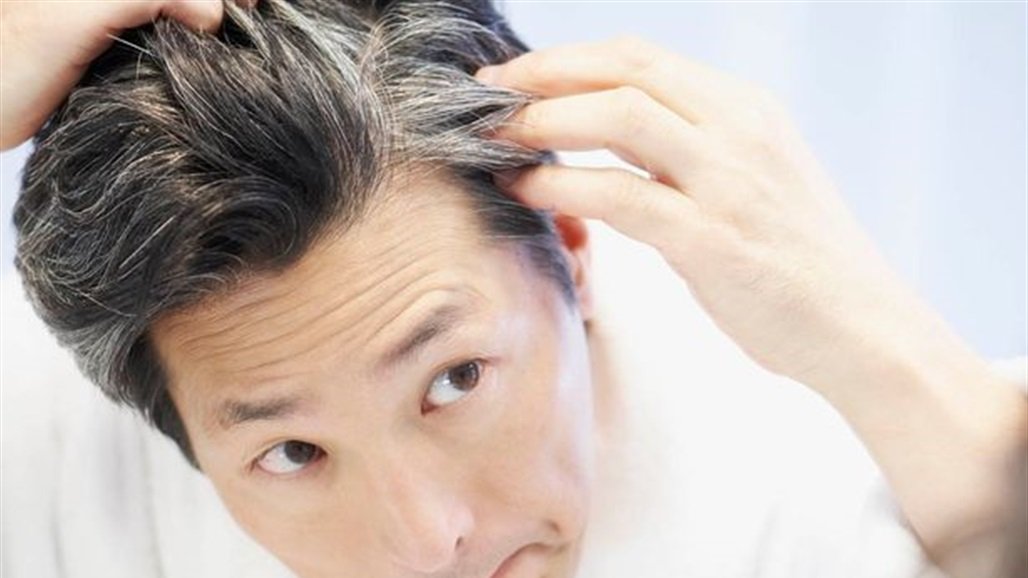 هل ظهور الشعر الأبيض مرتبط بالتوتر؟ 