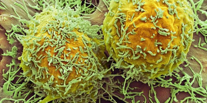 علماء يكتشفون دواء لـ "سرطان الرئة"