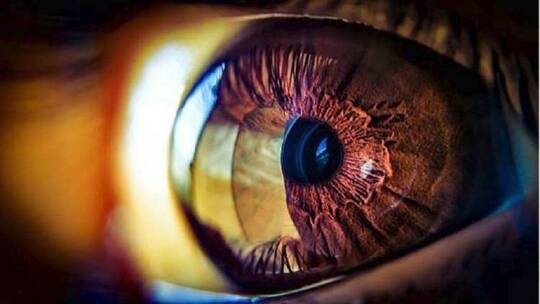 ضعف البصر والعمى قد يبلغ 900 مليون حالة حول العالم عام 2050