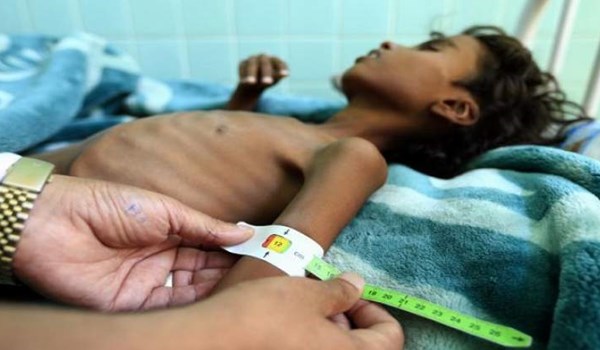 اليونيسف تحذر: المجاعة الوشيكة تهدد أطفال اليمن