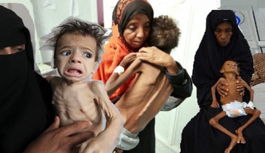 إيران توجّه رسالة إلى الأمم المتحدة حول المجاعة في اليمن