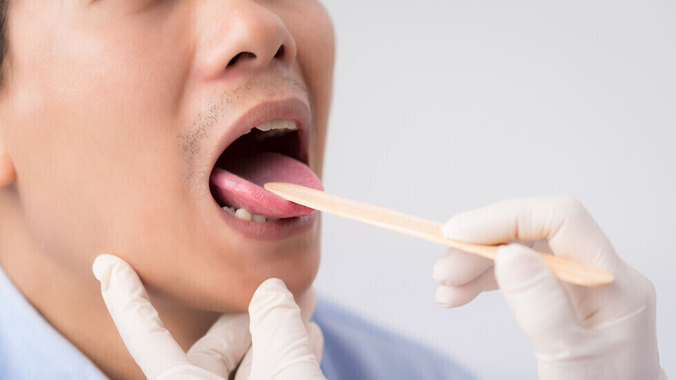 متى تكون تقرحات الفم علامة على الإصابة بالسرطان؟