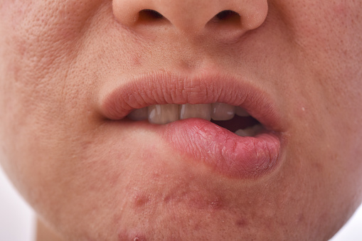 شعور مستمر غير مبرر على الشفاه قد يدل على الإصابة بسرطان الفم!