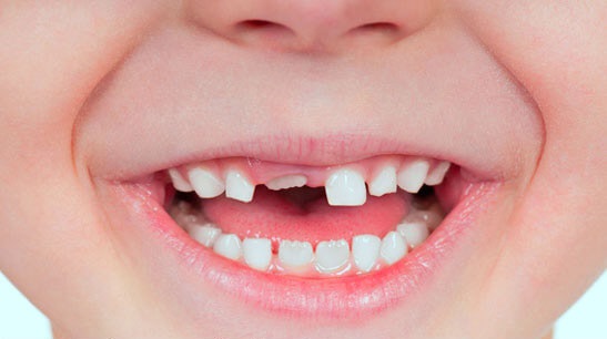 ابداع روشی برای رویاندن دوباره دندان‌های دائمی