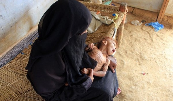 400 ألف طفل يمني مهددون بالموت جوعاً