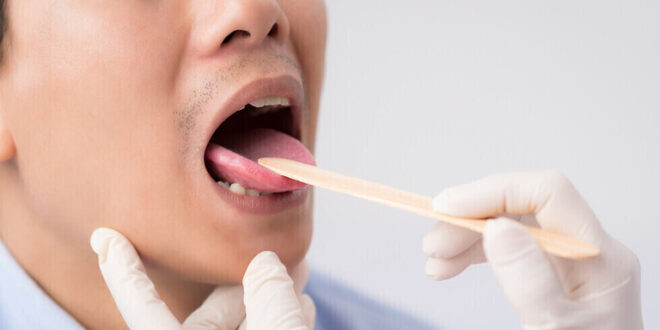 علامتان في الفم تدلان على ارتفاع مستويات السكر في الدم