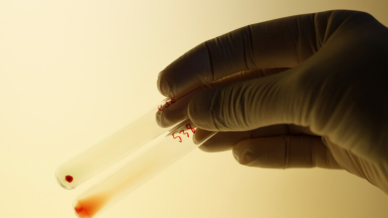 علماء يكتشفون علاقة بين أمراض خطيرة ونوع فصيلة الدم