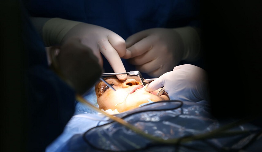 فريق طبي ايراني ينجح في عملية جراحية نادرة لترميم الفك