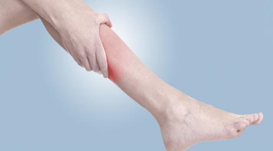 علامات على ساقيك تدل على أنك تعاني من مرض خطير