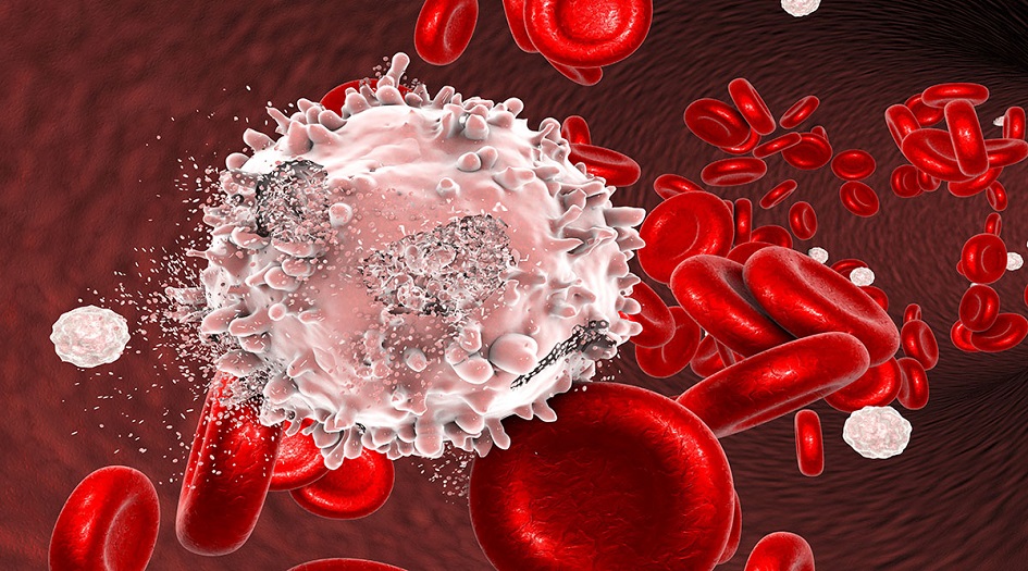 ثلاثة أعراض لسرطان الدم غالبا ما يتجاهلها الناس وقد تكون قاتلة!