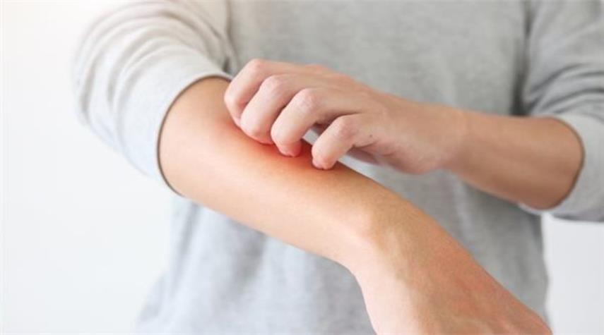 علامات على الجلد تدلل على الإصابة بأوميكرون