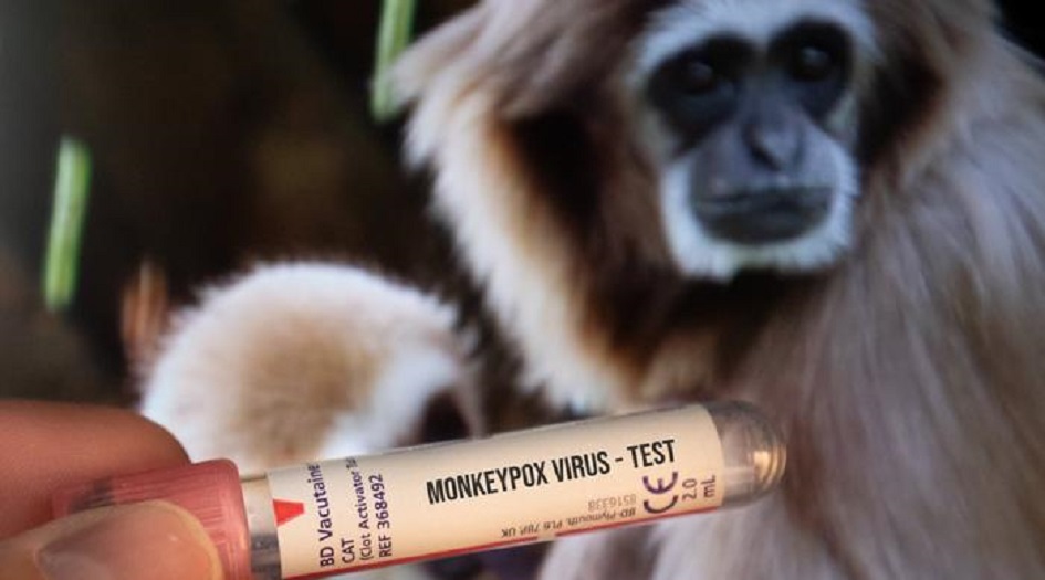 الصحة العالمية تسجل إصابات جديدة بجدري القرود في 23 دولة