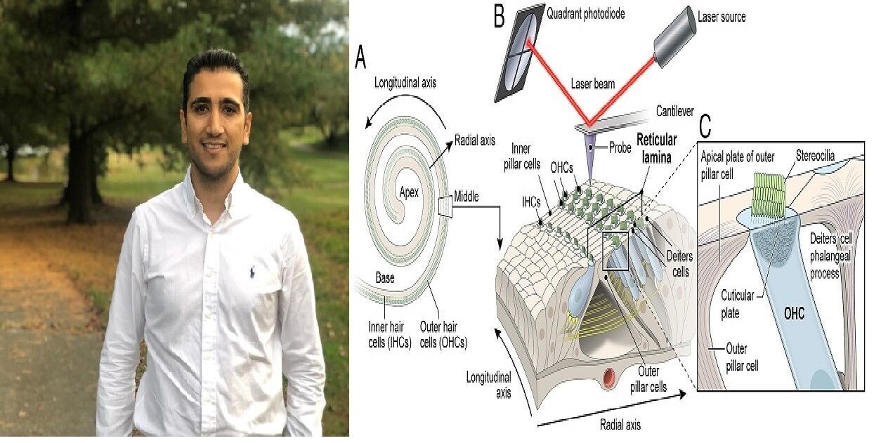 باحث إيراني يتمكن من اكتشاف الجين المسؤول عن فقدان السمع