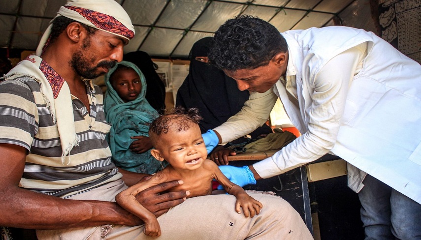  سوء تغذیه شدید کودکان یمنی ؛ افزایش 66درصدی آمار