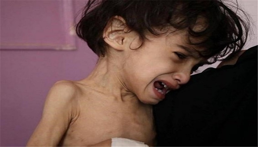لکه ننگ بر پیشانی جامعه جهانی و بشریت/ شهادت کودکان غزه بر اثر گرسنگی